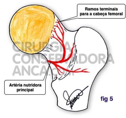 cirurgiaconservadoraanca anca norma fig.5