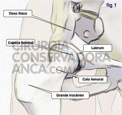 cirurgiaconservadoraanca anca norma fig.1