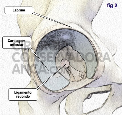 cirurgiaconservadoraanca anca norma fig.2