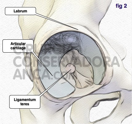 cirurgiaconservadoraanca anca norma fig.2