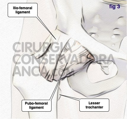cirurgiaconservadoraanca normal hip fig 3