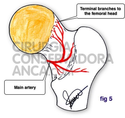 cirurgiaconservadoraanca normal hip fig 5