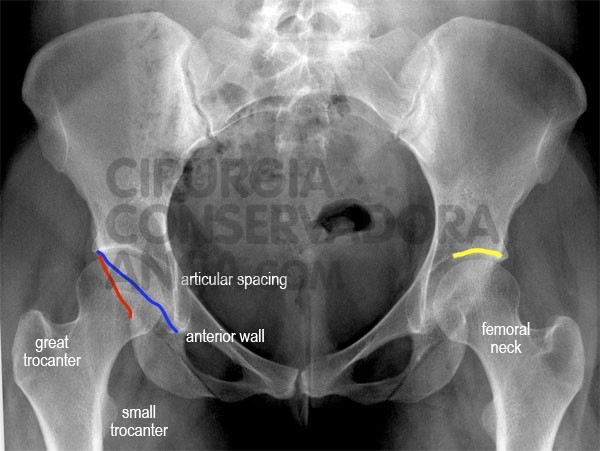 Rx - anca normal- figura 3 - paulo rego