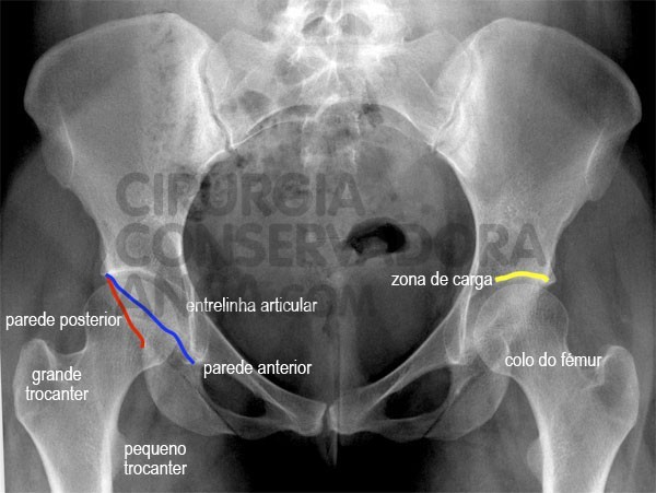 Rx - anca normal- figura 3 - paulo rego